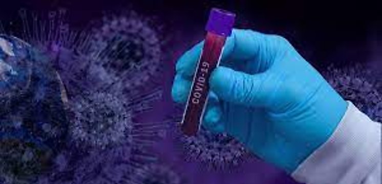 Panamá mantiene 2086 casos activos de coronavirus