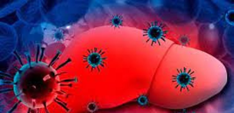 Importancia de un diagnóstico temprano para salvar vidas caso de Hepatitis C
